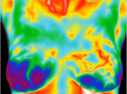 Thermal image of chest